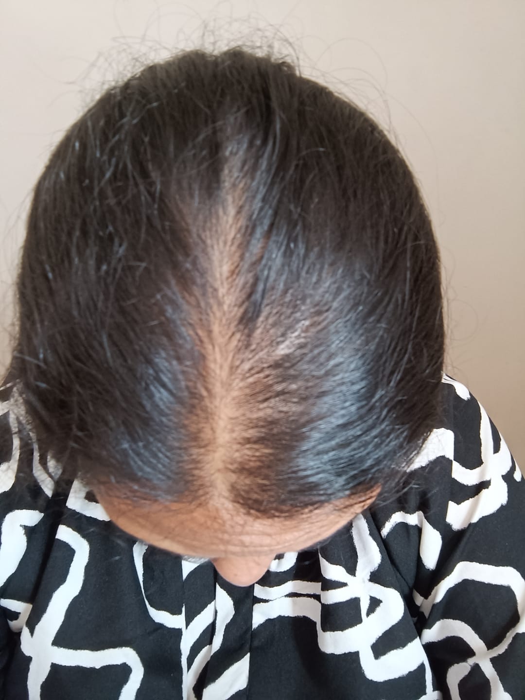 Customer photo review of Hannon Hair Growth Follicle Booster 125ml