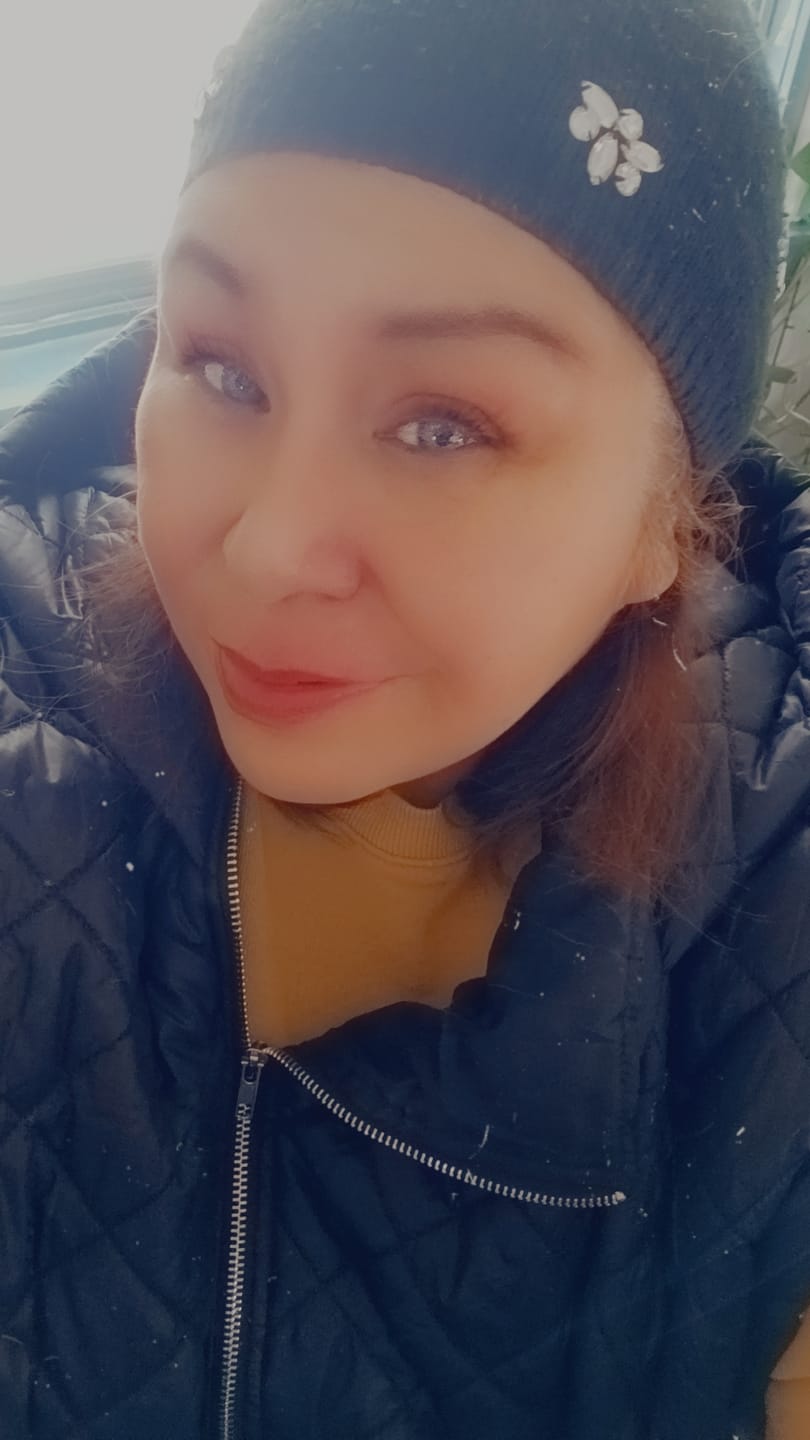Customer photo review of Aine Swan Lake Blue Prescription Colored Contact Lenses
