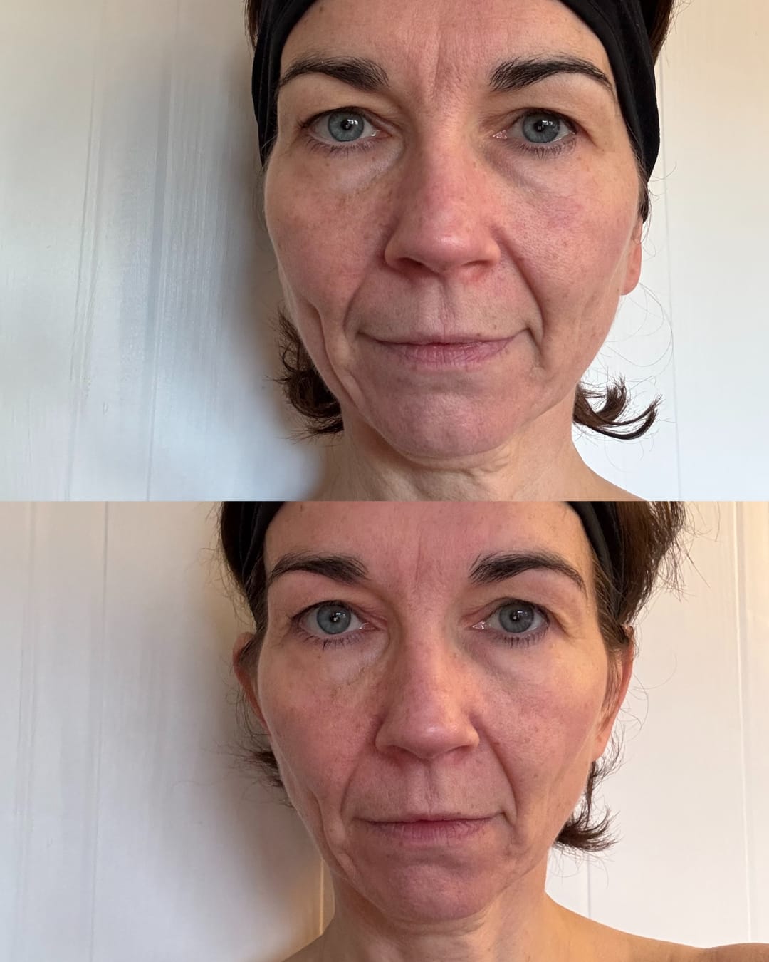 Customer photo review of Bakuchiol Cream