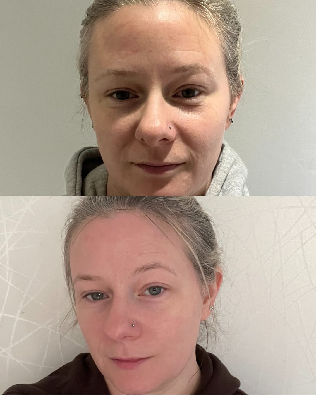 Customer photo review of Bakuchiol Cream