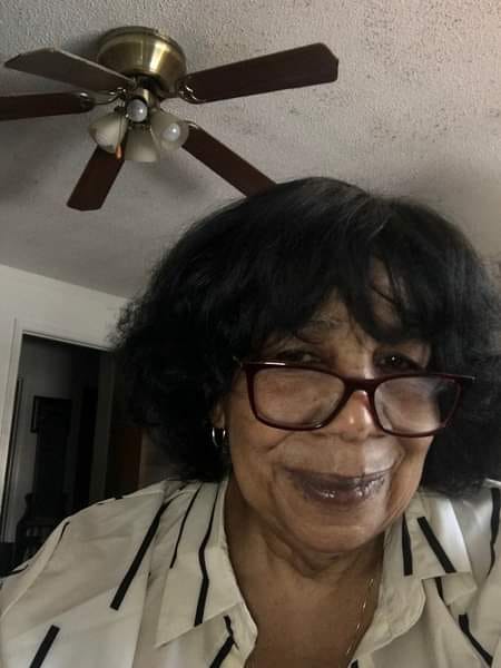 Customer photo review of LightenUp Anti-Aging Lightening Cream - 100ml