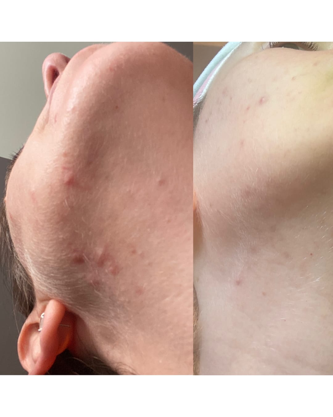 Customer photo review of Bakuchiol Cream