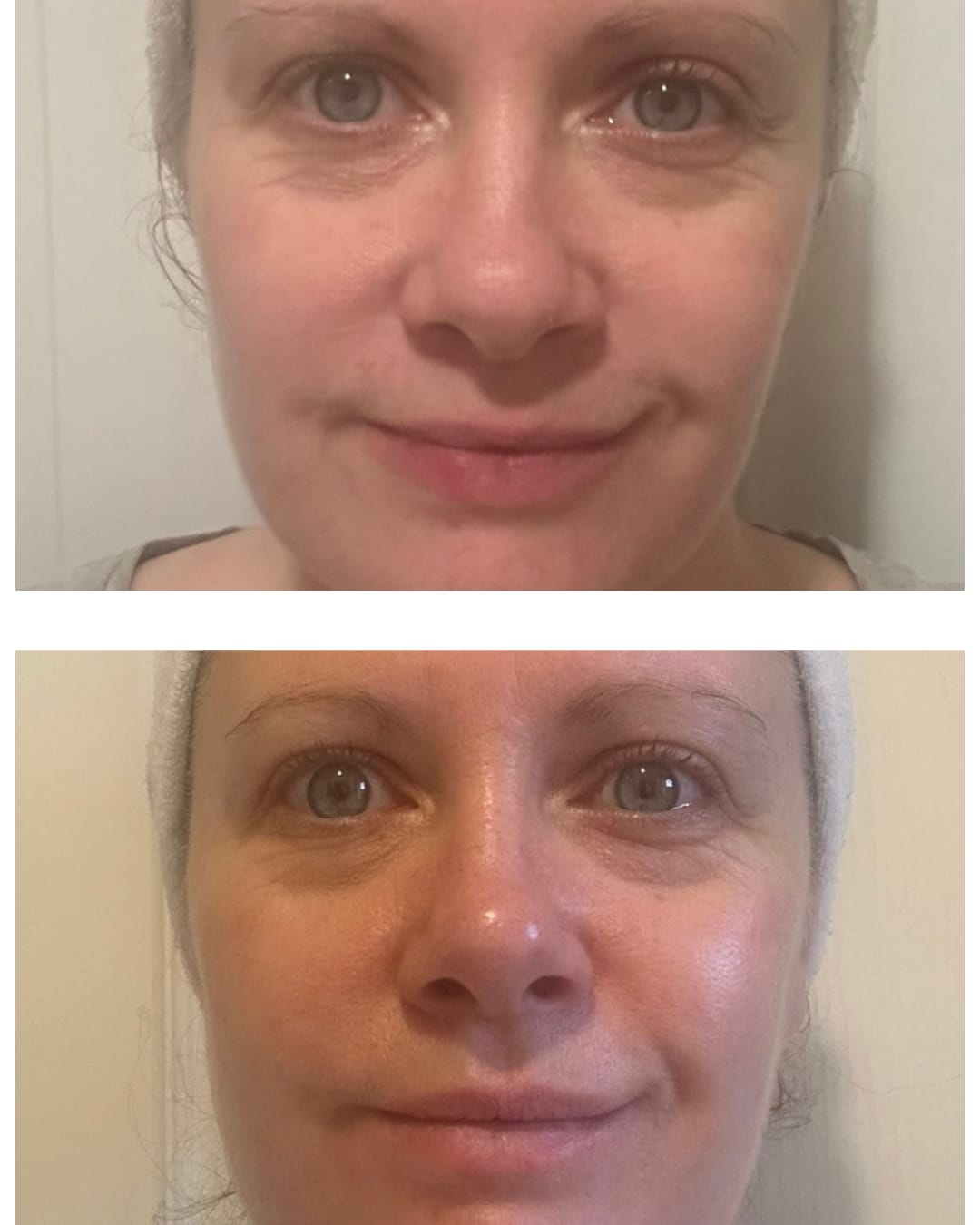 Customer photo review of Bakuchiol Cream