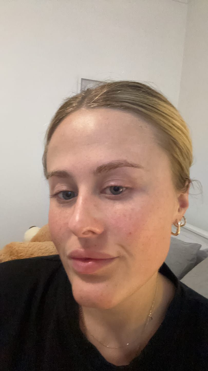 Customer photo review of The Naked Skin™ Collagen Overnight Wrapping Mask