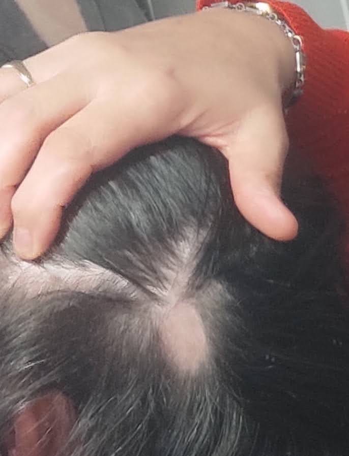 Customer photo review of Sérum de croissance pour cheveux (1 mois)