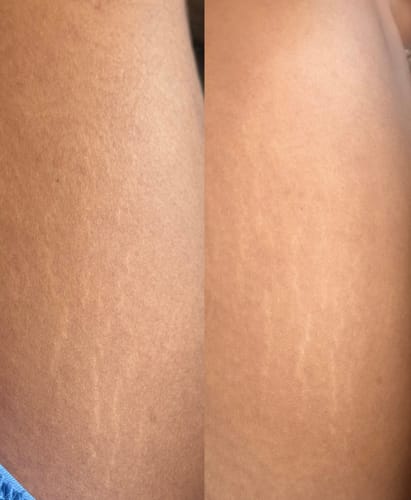 Customer photo review of Booty Kween
