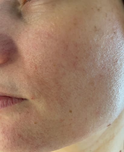 Customer photo review of Exfoliating Bar - Tepezcohuite