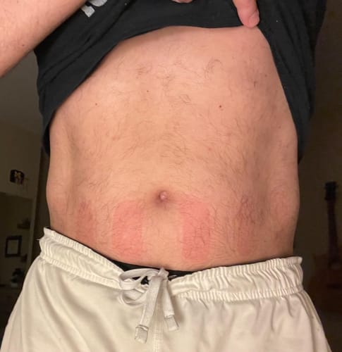 Customer photo review of NextGen Full-Body Stimulation Kit