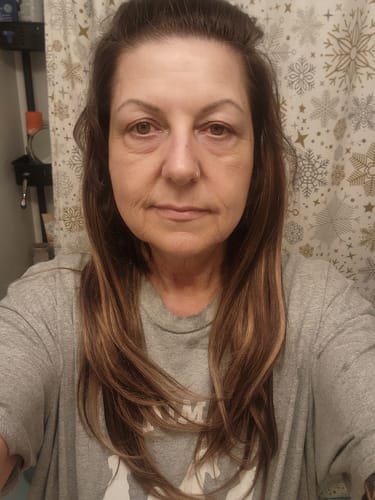 Customer photo review of Glov Micro Infusion System