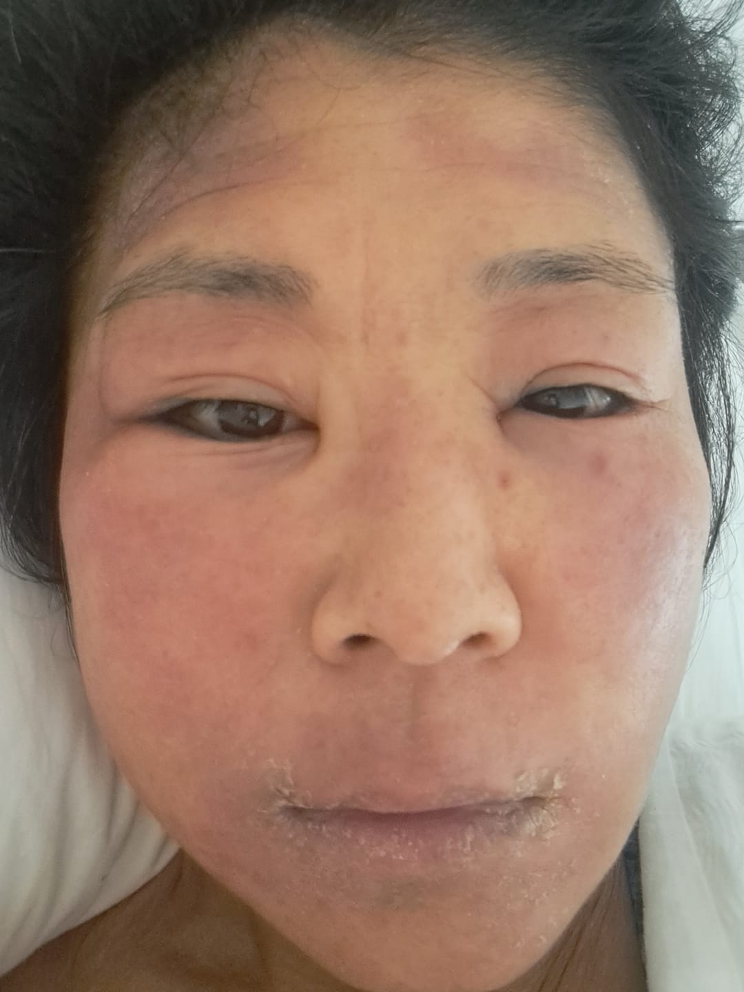 Customer photo review of DermaGen Manuka Balm - Your #1 Mulitpurpose Balm for the Family