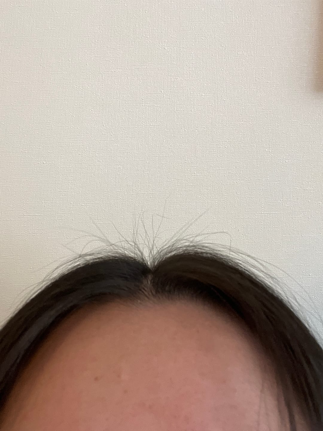 Customer photo review of Tónico Anticaída