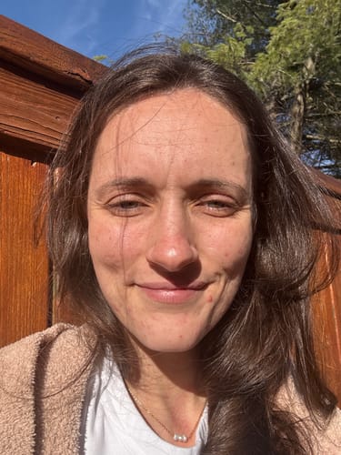 Customer photo review of Glow Getter | Face Mask