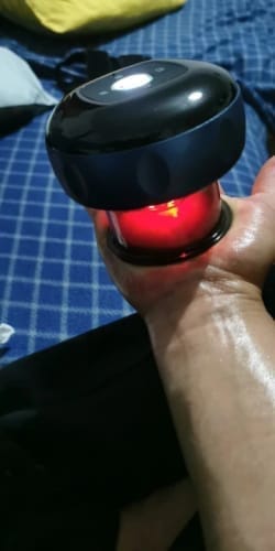 Customer photo review of The Pulse Cup™ Cupping Therapy Massager