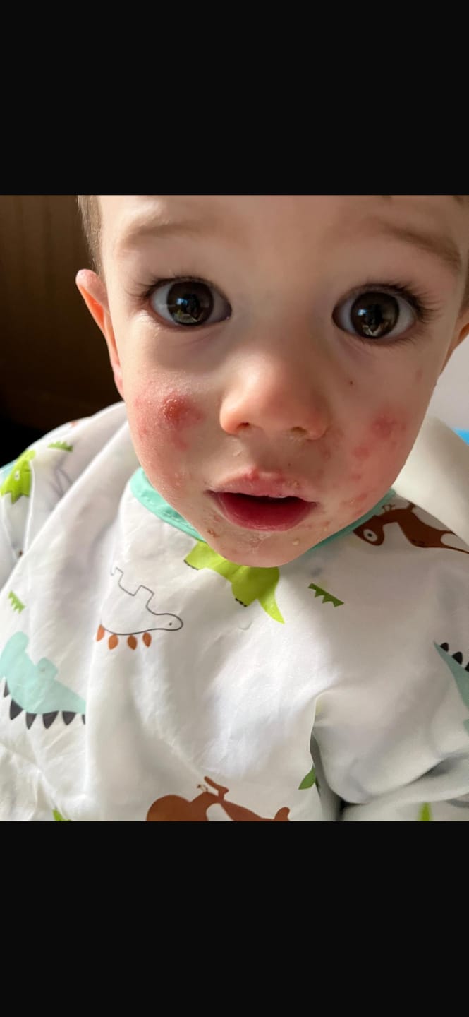 Customer photo review of Grass-Fed Tallow Soap | Moisturising Cleansing Bar
