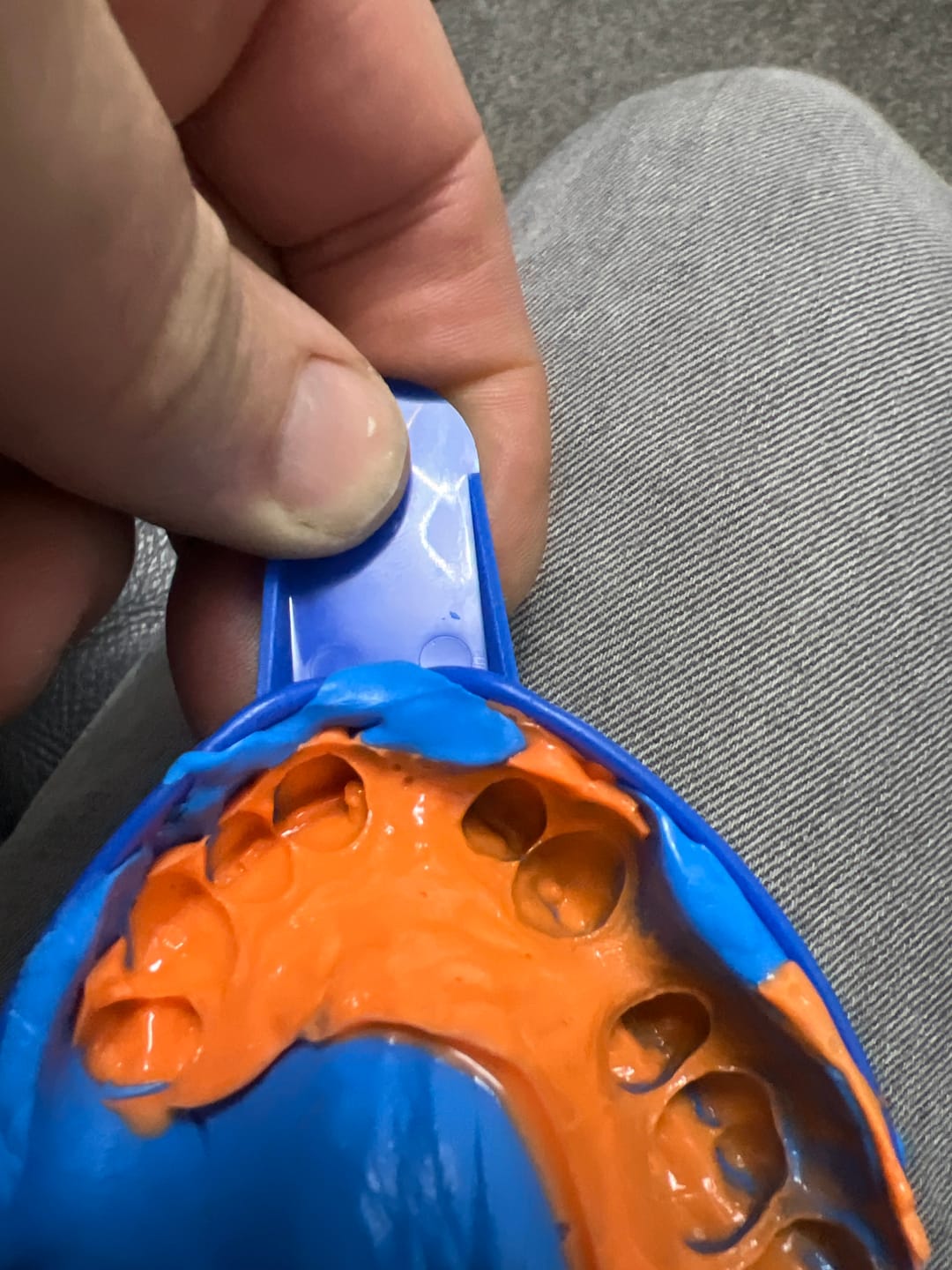 Customer photo review of Upper Impression Kit