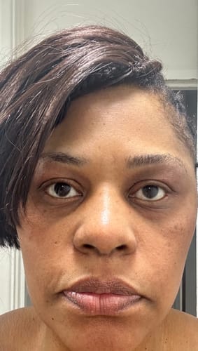 Customer photo review of Collagen Night Wrapping Mask