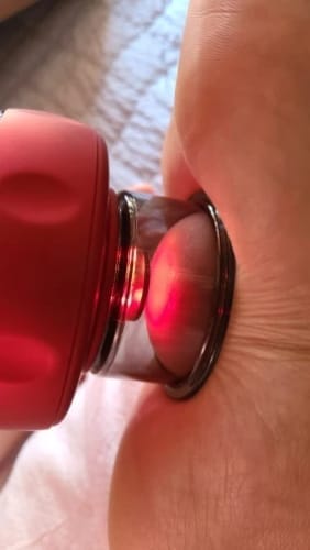 Customer photo review of The Pulse Cup™ Cupping Therapy Massager