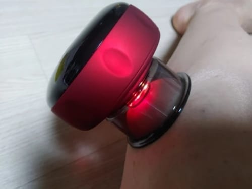Customer photo review of The Pulse Cup™ Cupping Therapy Massager
