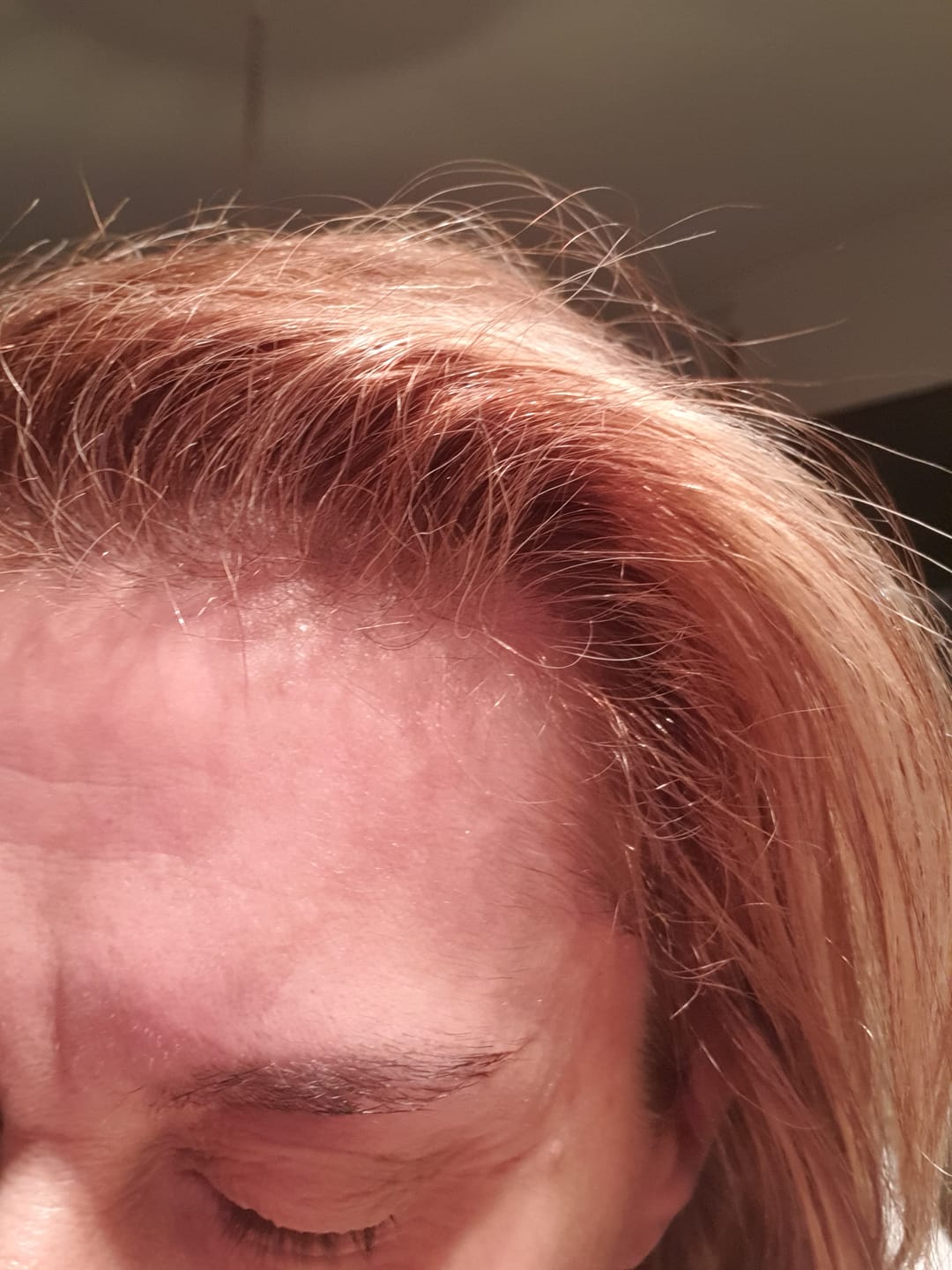 Customer photo review of Shampoing Solide Gingembre Anti chute & Pousse de cheveux - ECLAMA