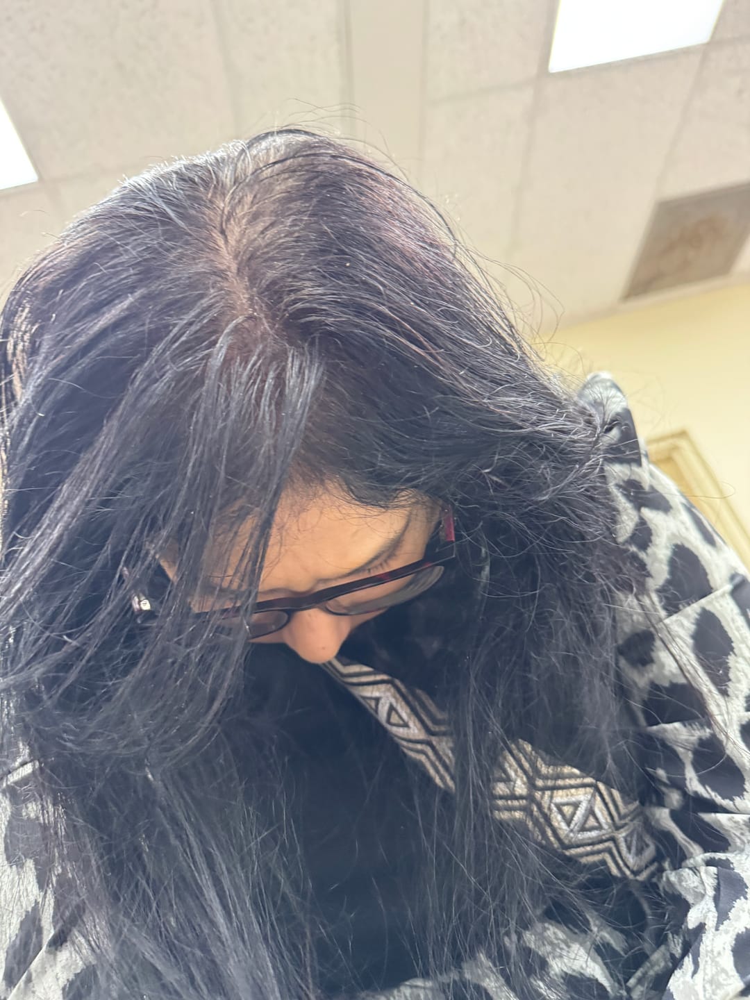Customer photo review of Complex10™ Hair Growth Supplement