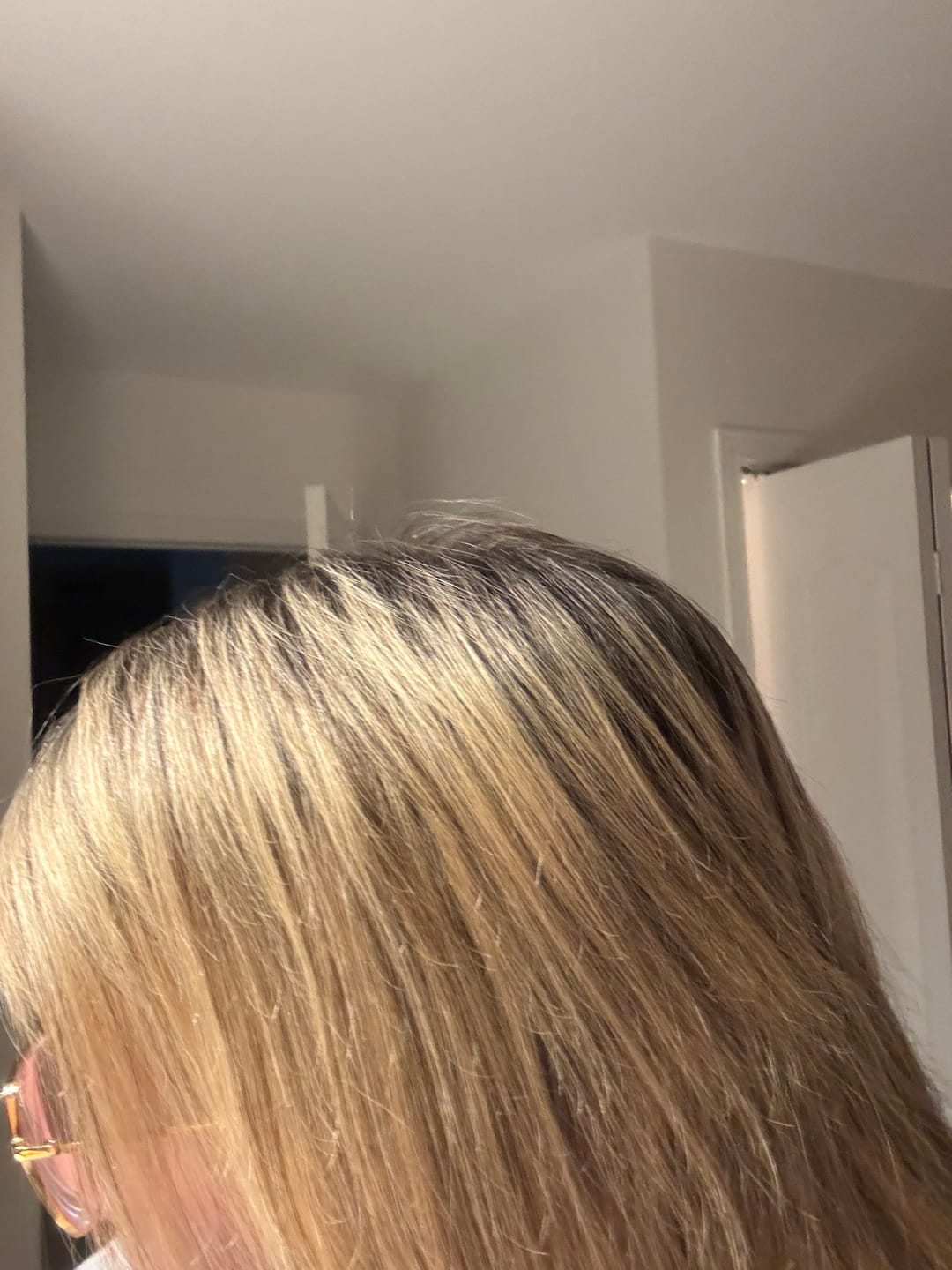 Customer photo review of Sérum Fortifiant Anti-Chute Genesis