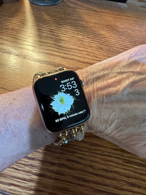 Customer photo review of Pearly Rosette Stretch Apple Watch Strap