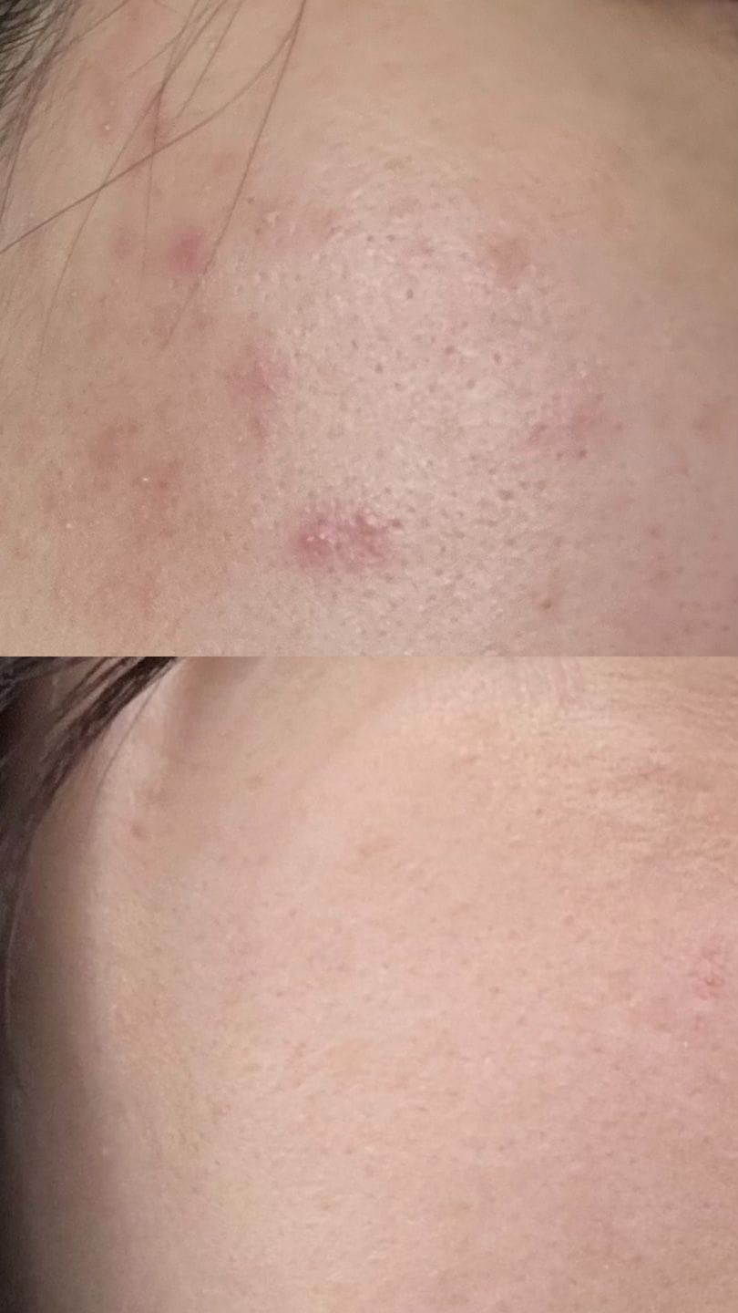 Customer photo review of Glutathiosome dark spot serum Vita drop
