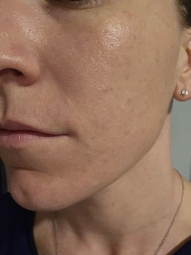 Customer photo review of Skincare Starter bundle - Trial