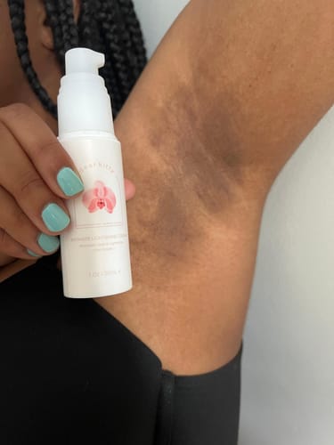 Customer photo review of Intimate Lightening Cream