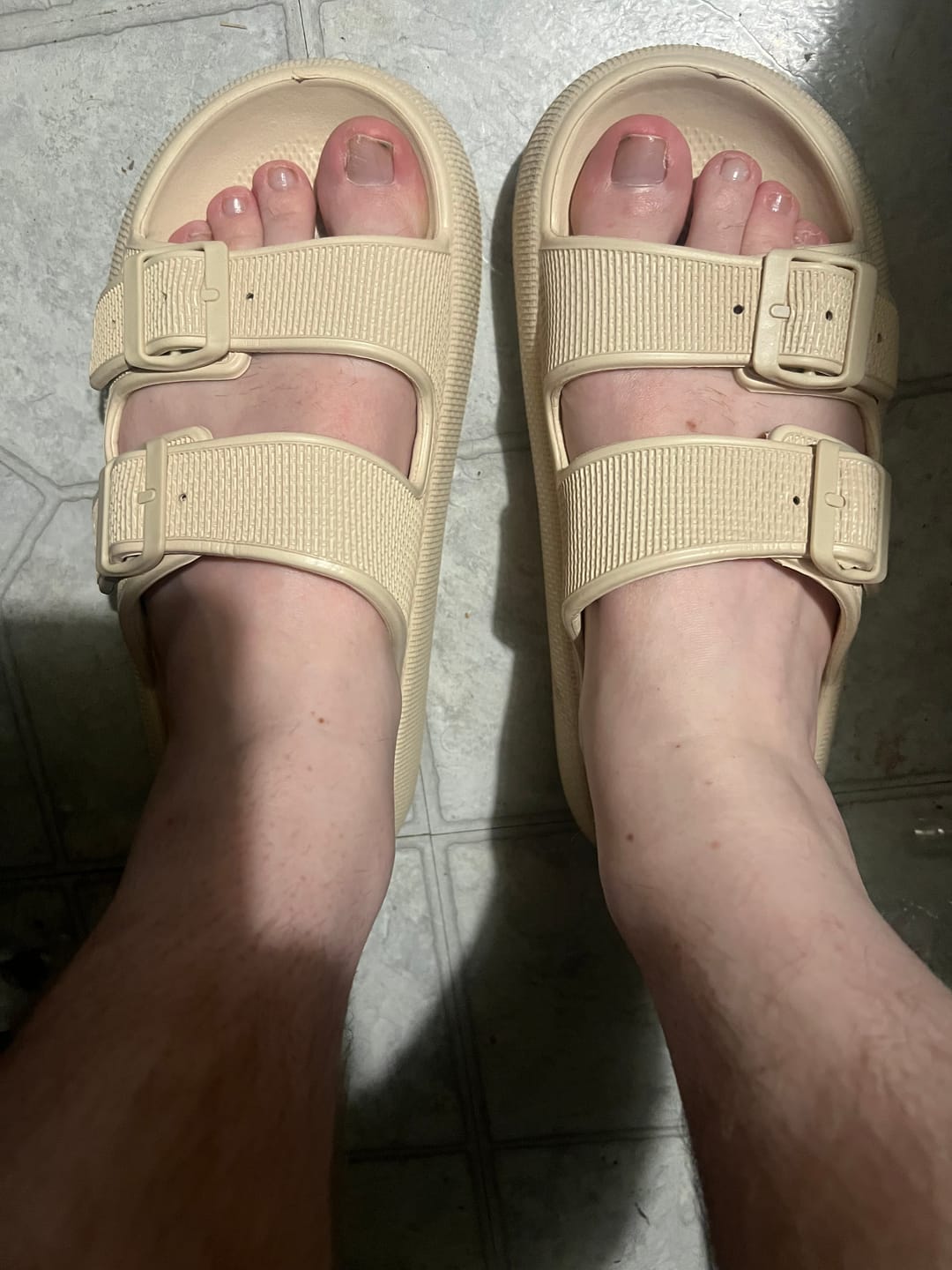 Customer photo review of The Snuggi Sandals