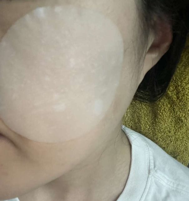 Customer photo review of Glutathiosome dark spot pad Vita touch