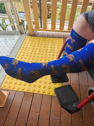 Customer photo review of Sloth Bamboo Compression Socks