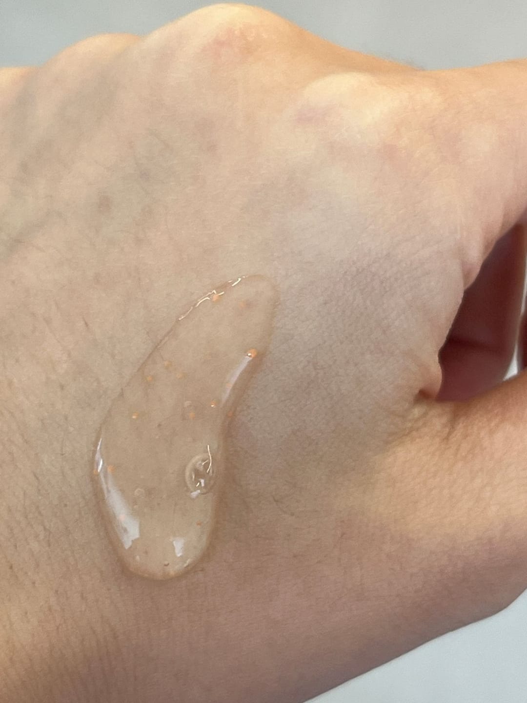 Customer photo review of Glutathiosome dark spot serum Vita drop