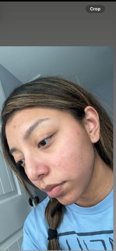 Customer photo review of Turmeric Brightening Soap (with Vitamin C, Alpha Arbutin, Oat)