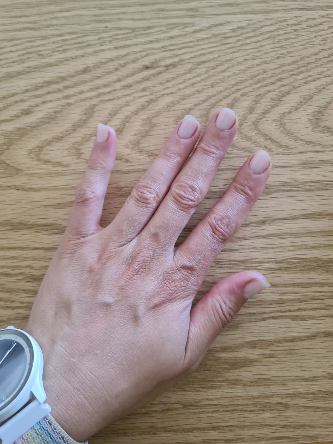 Customer photo review of Crystal Clear DIY Semicured Gel Nail Sticker Kit (STOP NAIL BITING & GROW BRITTLE NAILS)