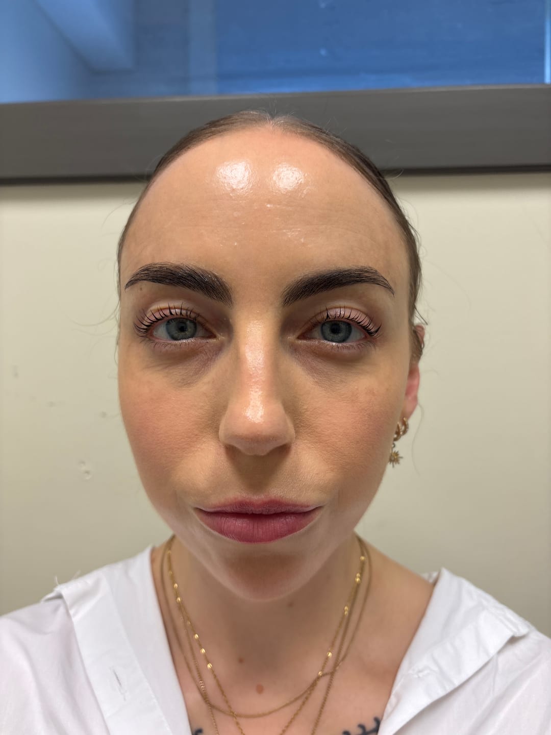 Customer photo review of Black Lash Serum