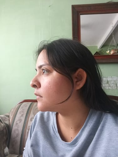 Customer photo review of Formula Personalizada (Rx)