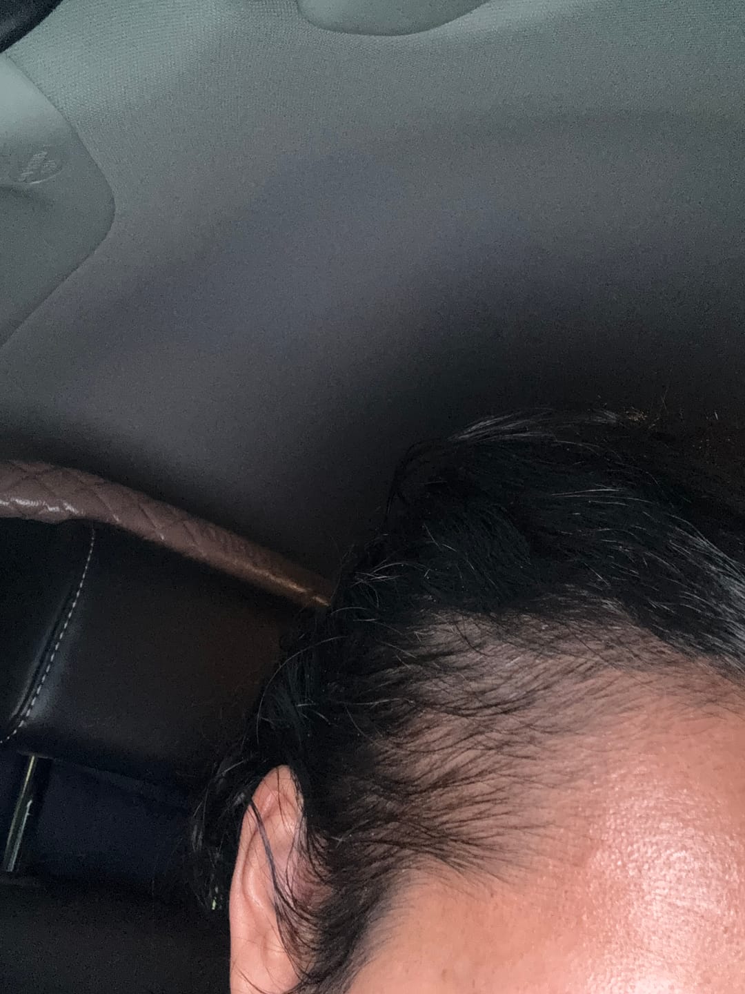Customer photo review of Rosemary Elixir - 100% Natural Hair Loss Solution