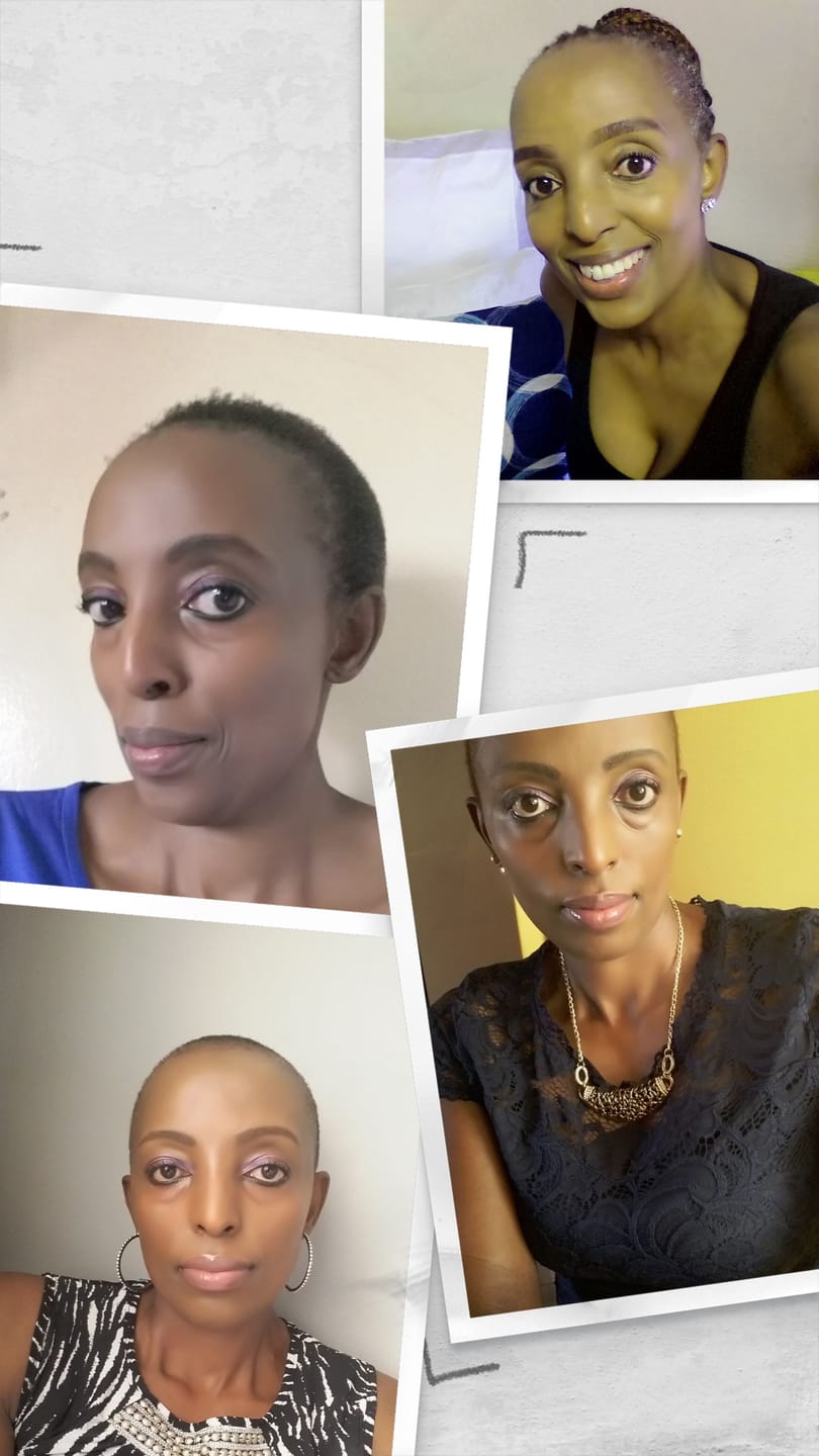 Customer photo review of Brazilian Pixie Wig - Straight