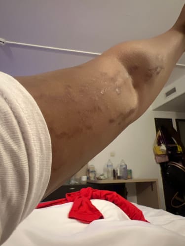 Customer photo review of Peeling savon noir anti vergetures