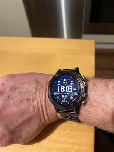 Customer photo review of HYPER SMARTWATCH PRO®