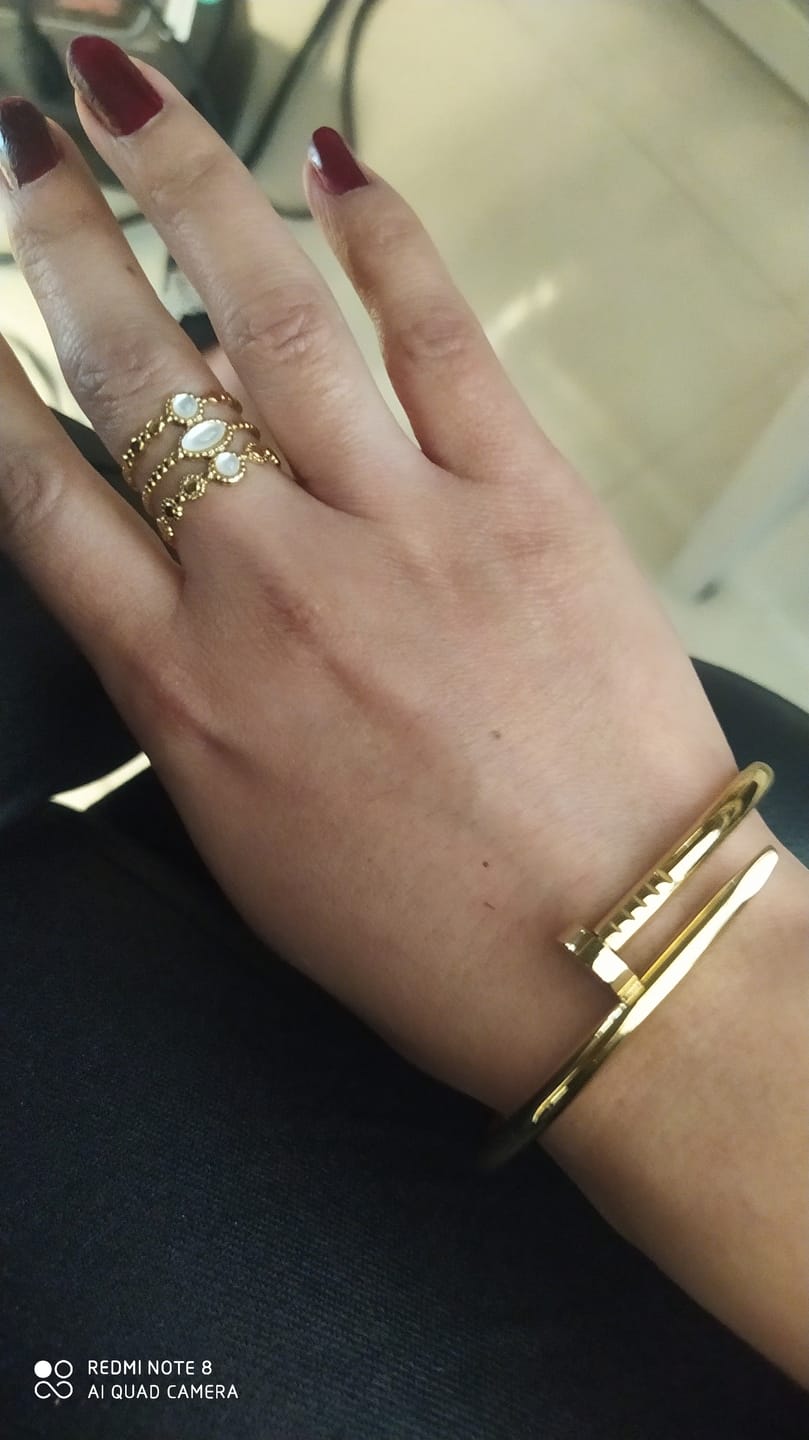 Customer photo review of Anillo Ajustable Albo