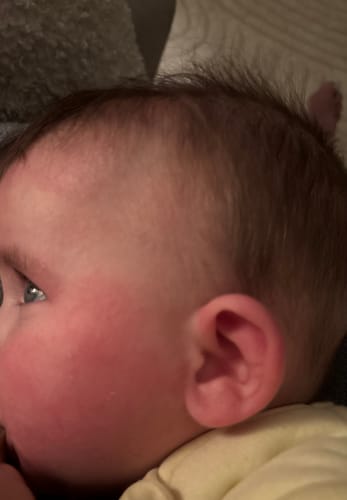 Customer photo review of Neptune Grass Fed Tallow & Honey Balm