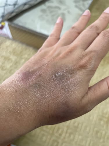 Customer photo review of Jolicare Cream
