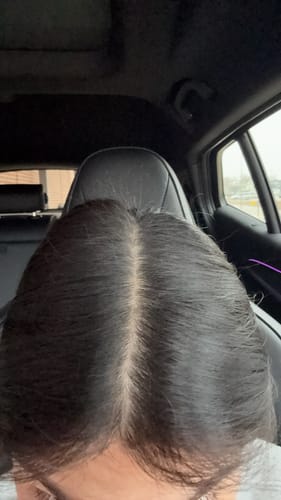 Customer photo review of TR Hair Oil Essentials Bundle ($66 value)