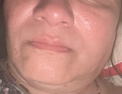 Customer photo review of SEA BUCKTHORN SERUM (100ml)