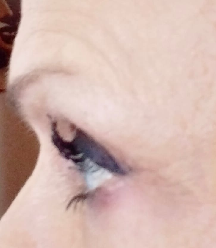 Customer photo review of Long Lashes FOREVER