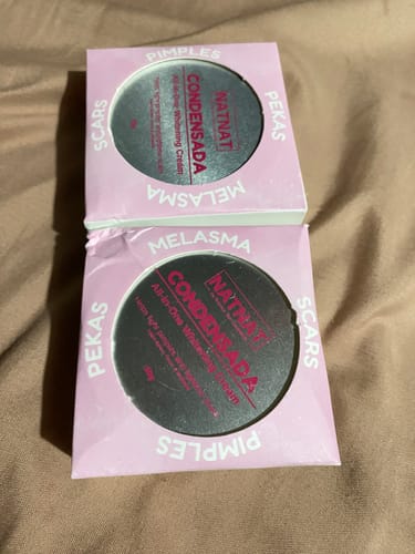 Customer photo review of Natnat Condensada PEKAS MELASMA all in one whitening cream