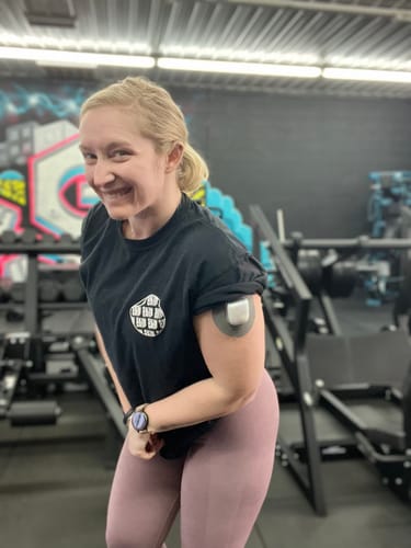 Customer photo review of Skin Grip Original - Omnipod Adhesive Patches