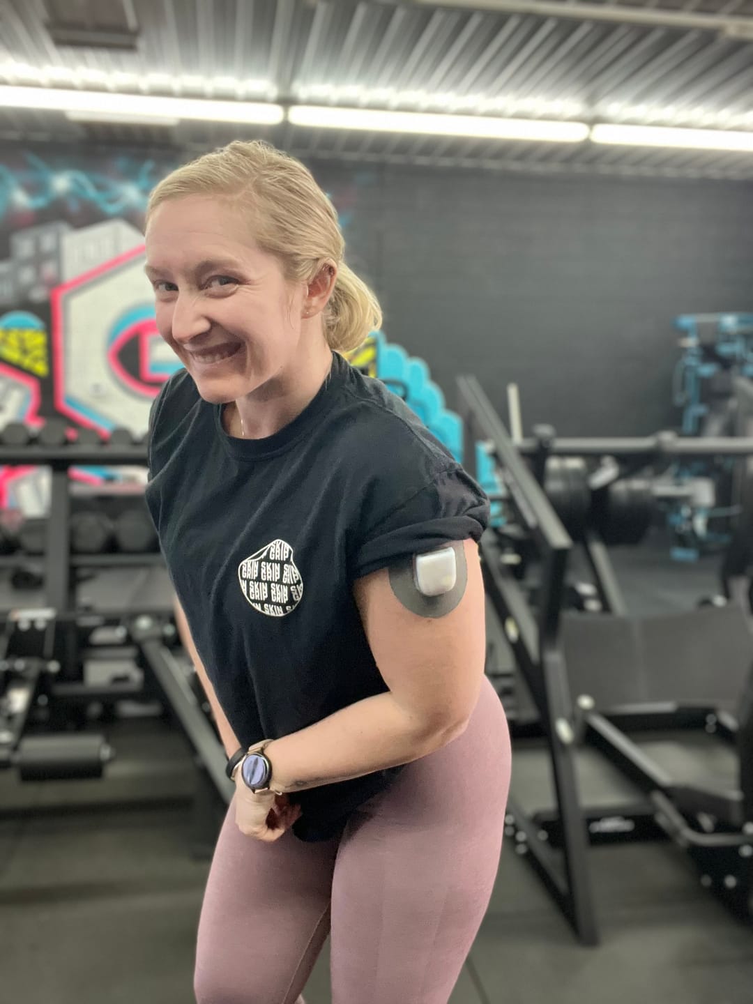 Customer photo review of Skin Grip Original - Omnipod Adhesive Patches